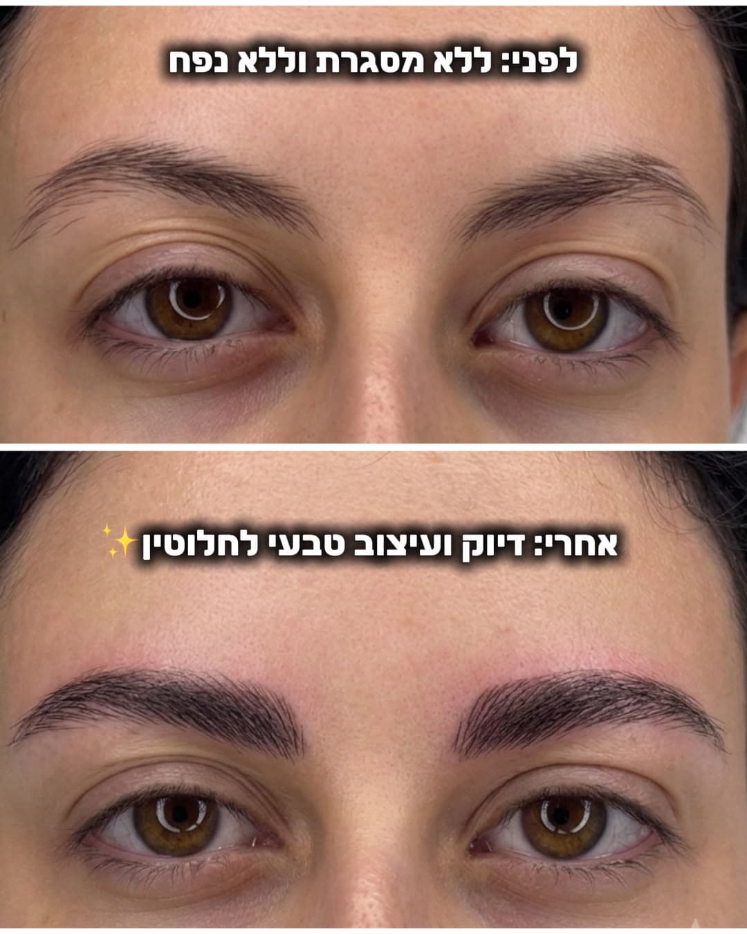 מיקרובליידינג — עבודה 4